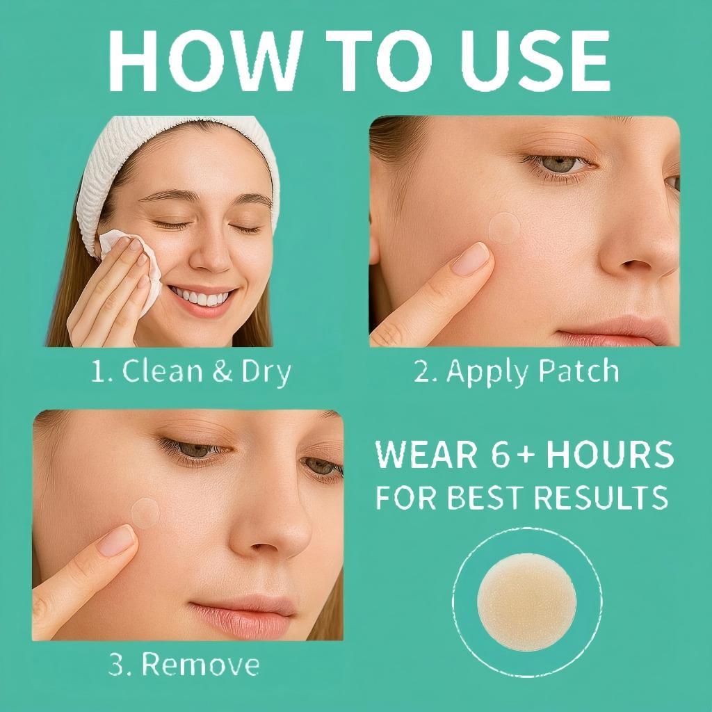 609ct Hydrocolloid Acne Patches – Fast-Acting Pimple Stickers for Face | All Skin Types